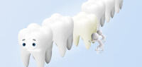 3D数字隐形正畸-牙科诊所